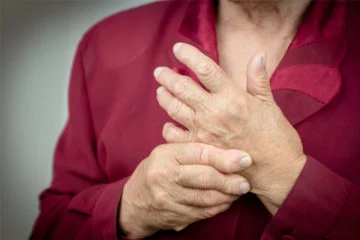 Rheumatoid Arthritis